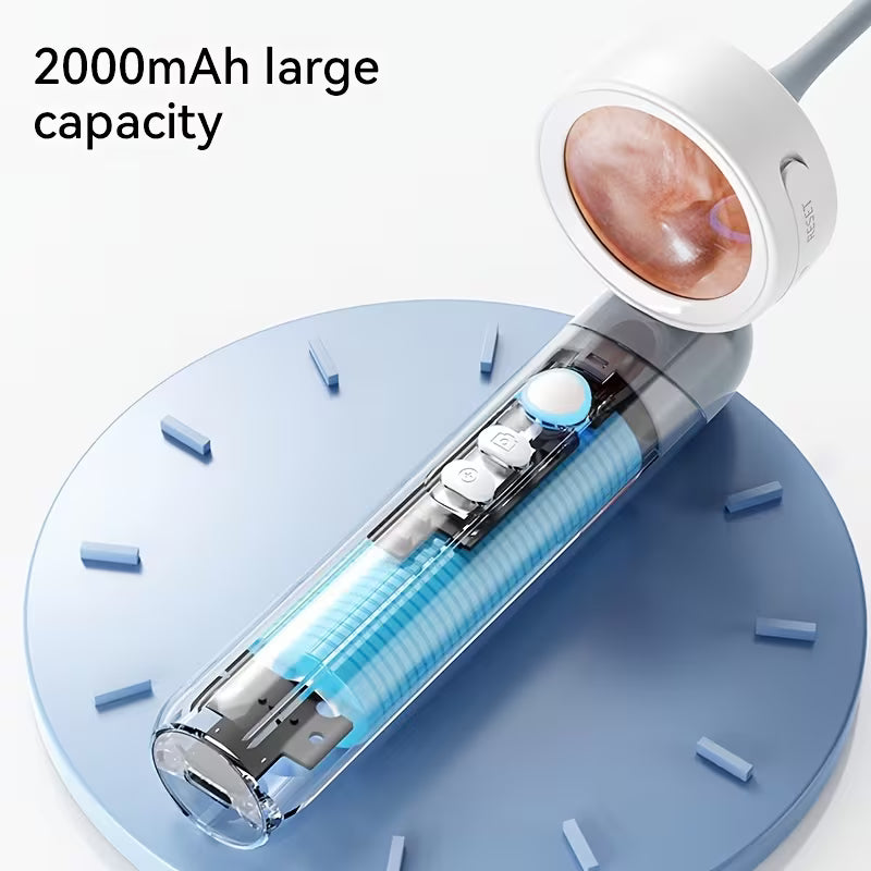 Otoscope Ear Camera With 1.38'' Screen, 1080P Ear Scope With 4 LEDs, 12 Silicone Specula Tips, Support Photo And Video, PC View, Ideal Pocket Otoscope For Home Use, And Pets