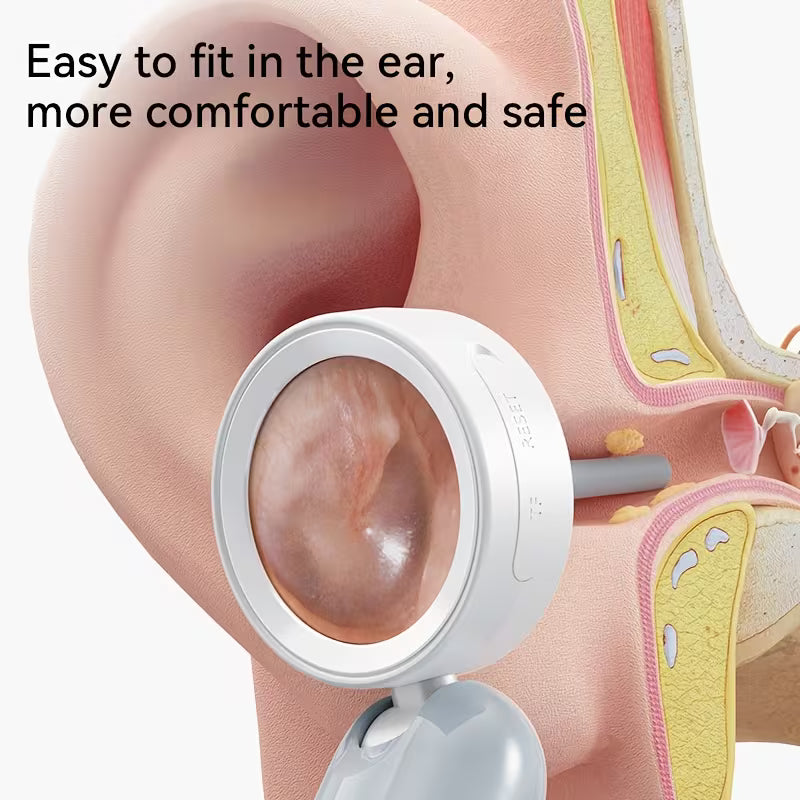 Otoscope Ear Camera With 1.38'' Screen, 1080P Ear Scope With 4 LEDs, 12 Silicone Specula Tips, Support Photo And Video, PC View, Ideal Pocket Otoscope For Home Use, And Pets