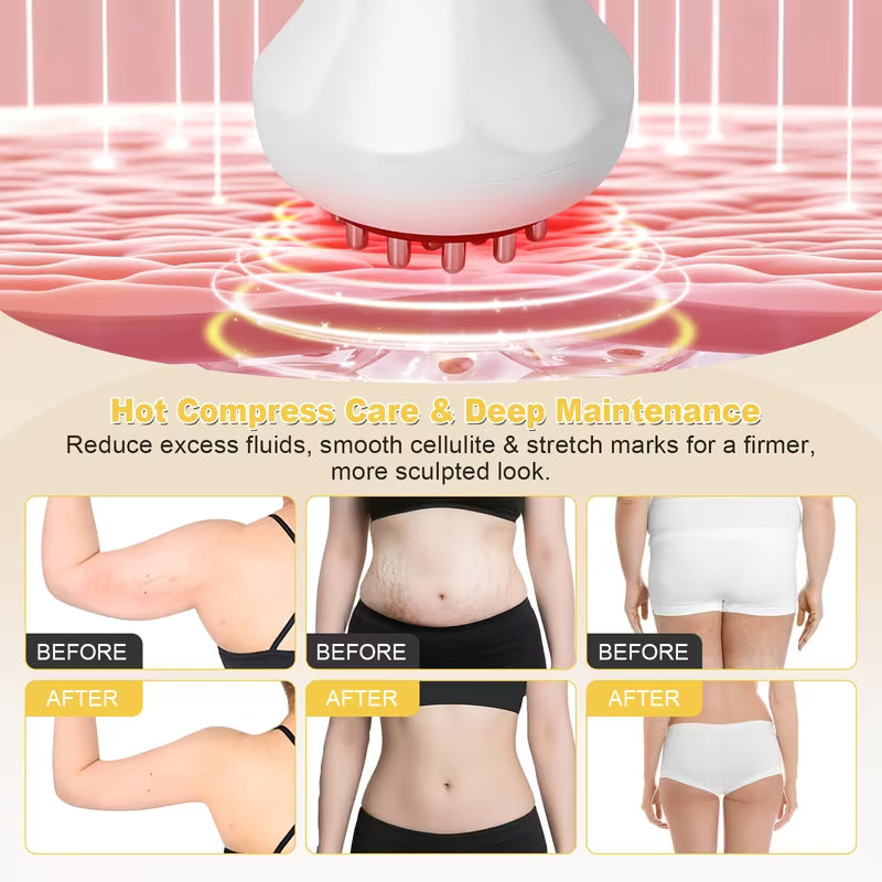 KTS Red Light Body Shaping Device, a Lymphatic Drainage Massager And Anti-Fat Massage Tool, Assists in Minimizing Stretch Marks And Fat Accumulation. It Can Also Serve As an Instrument for The Legs, Arms, Buttocks, Muscles