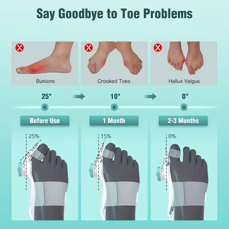 Device for Both Men And Women, Featuring an Adjustable Knob Splint for Bunions, Equipped with a Non-Slip Heel Strap, Compatible with Both Left And Right Feet